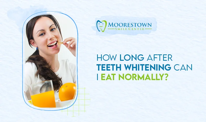 blog-teeth-whitening-after-eat-normaly